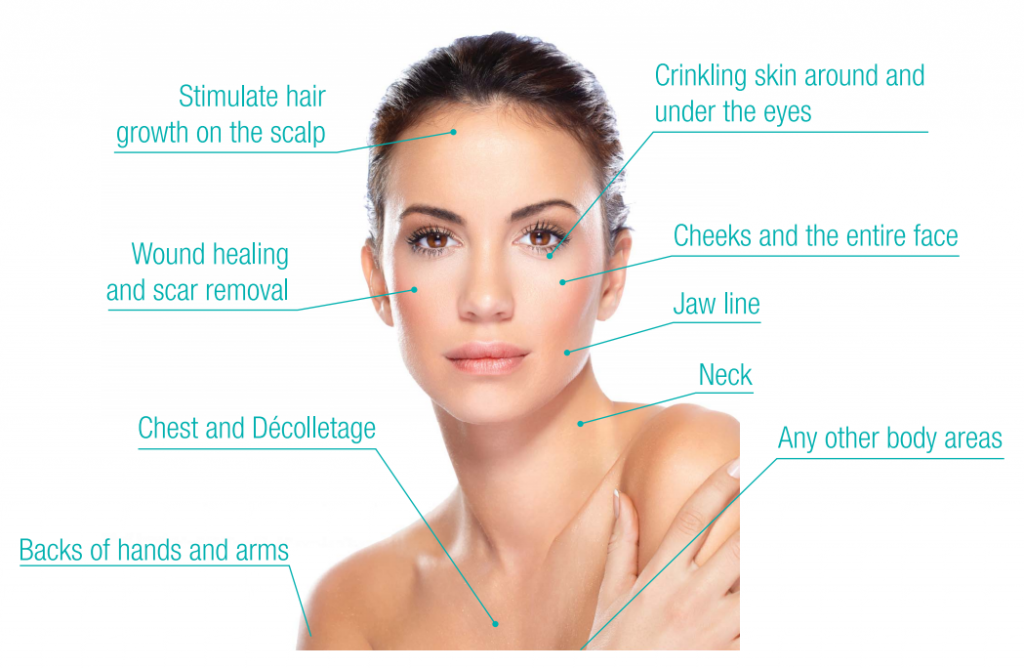 prp-microneedling